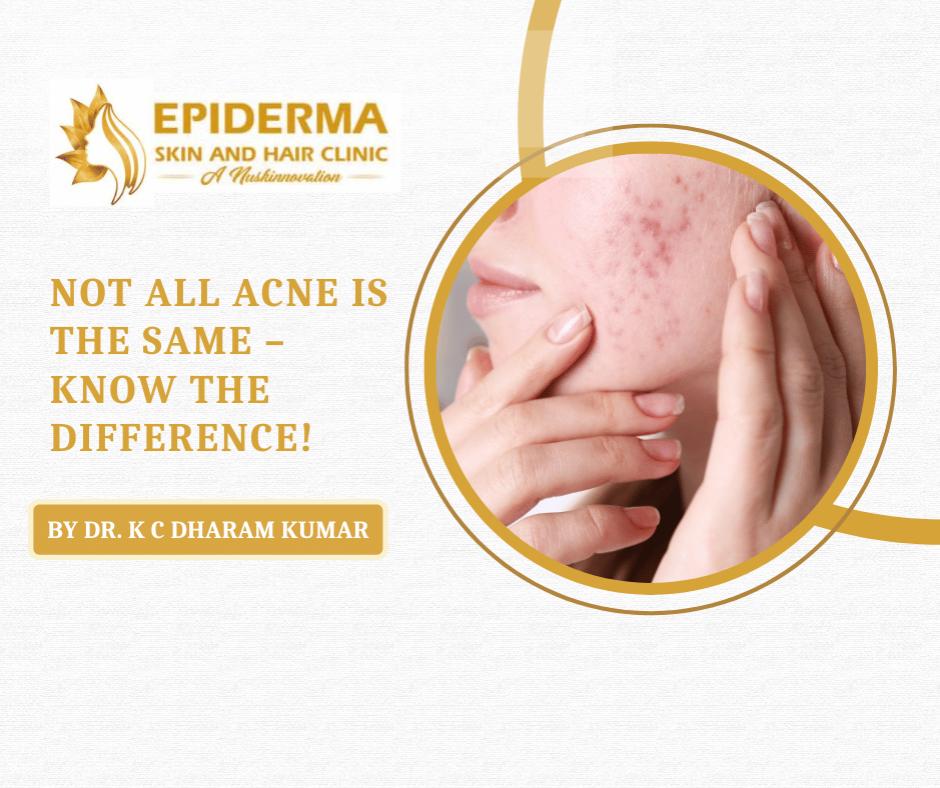 Best Dermatologist in Jayanagar.