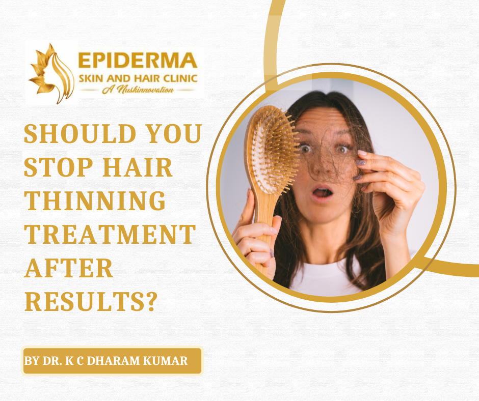 Hair thinning Treatment in Jayanagar