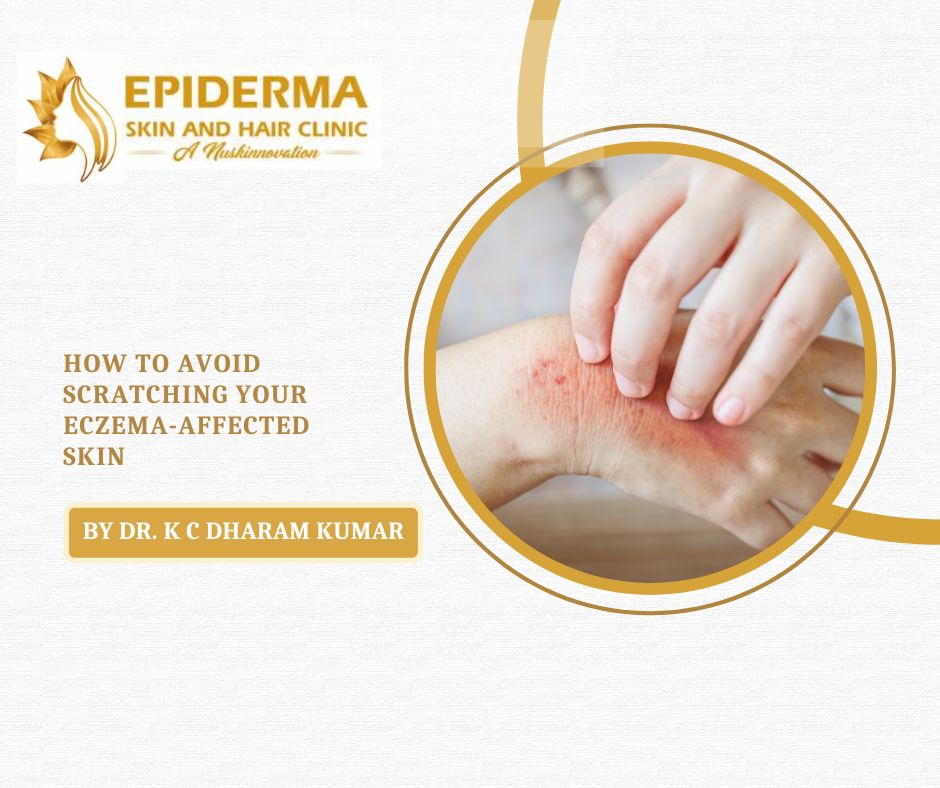 Best Skin Clinic in Bangalore | Dr. K.C. Dharam Kumar