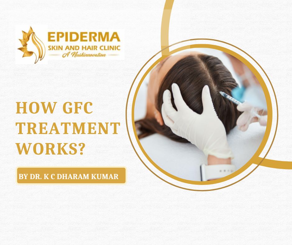 Hair Transplant Surgeons in Jayanagar