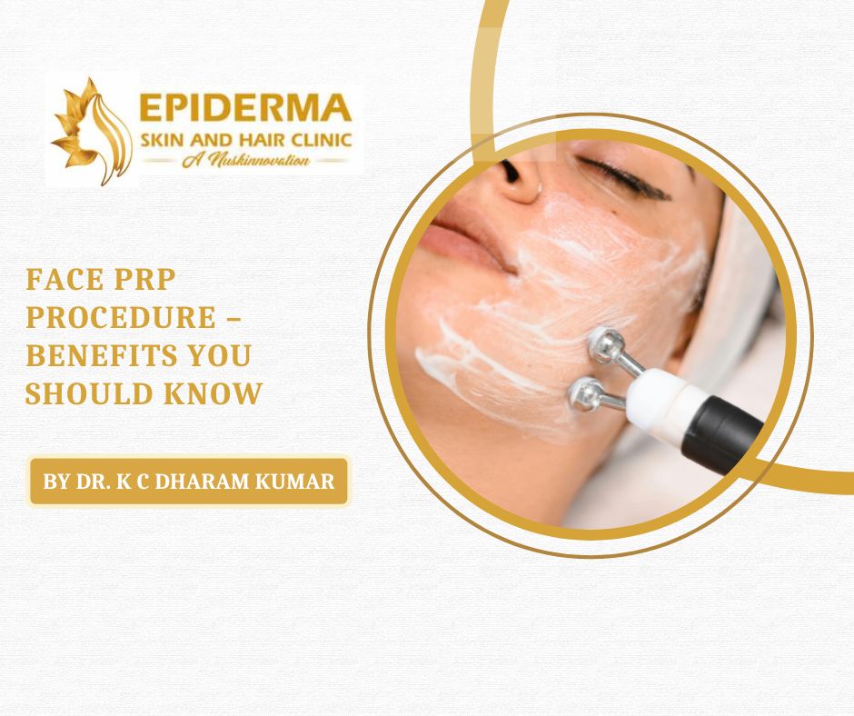 PRP treatment for face in Jayanagar,
