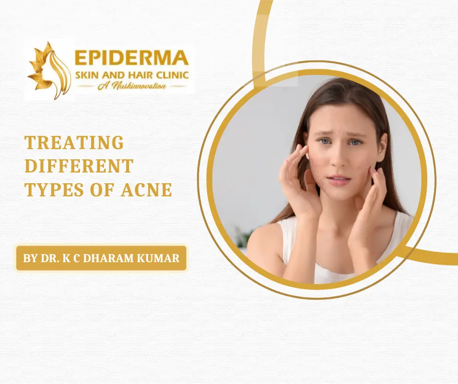 Best Skin Clinic In Jayanagar