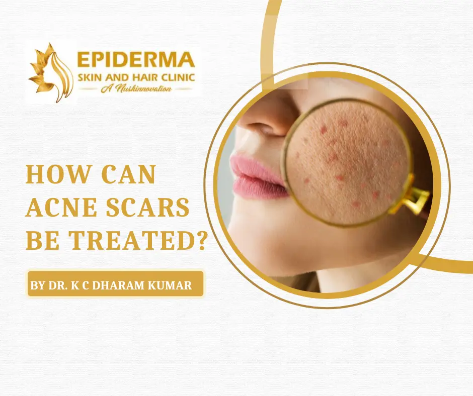 Best Dermatologist In Jayanagar