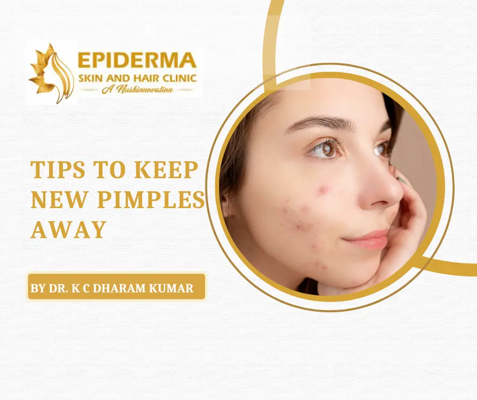 Best Acne Treatment in Jayanagar