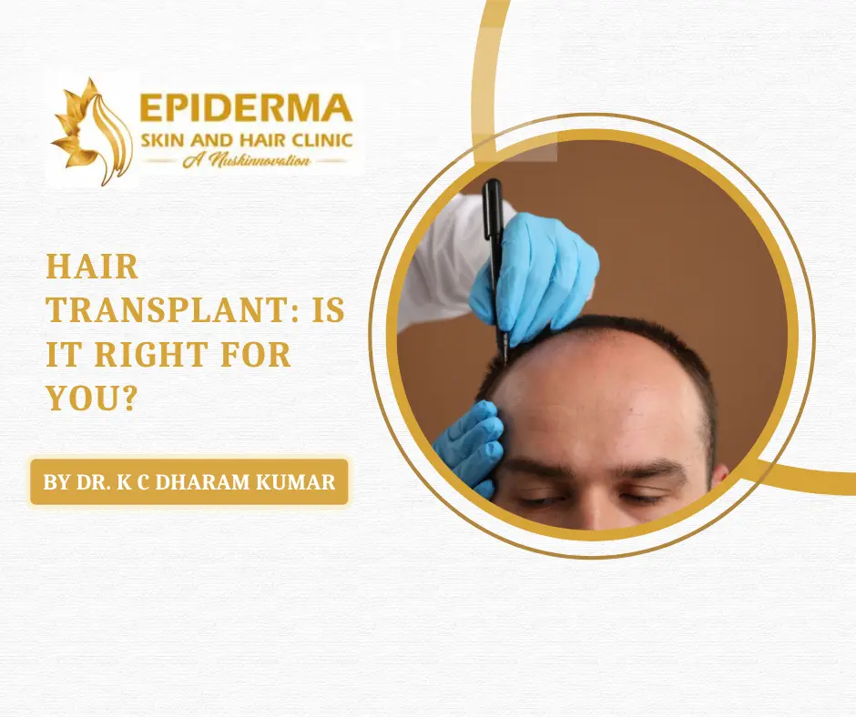 Best Hair Transplant Surgeon in Jayanagar