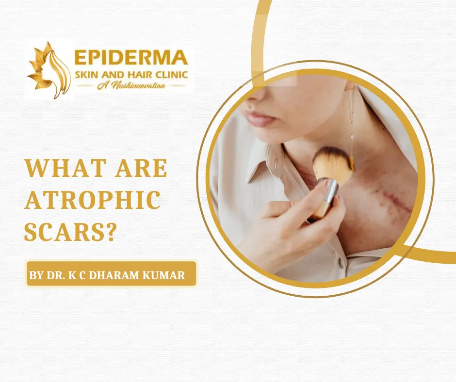 Best Skin Clinic In Jayanagar