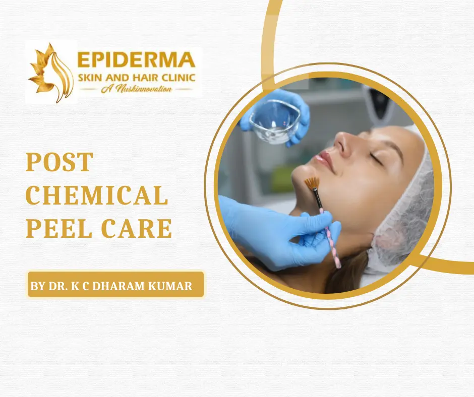 Chemical Peel Treatment in Jayanagar