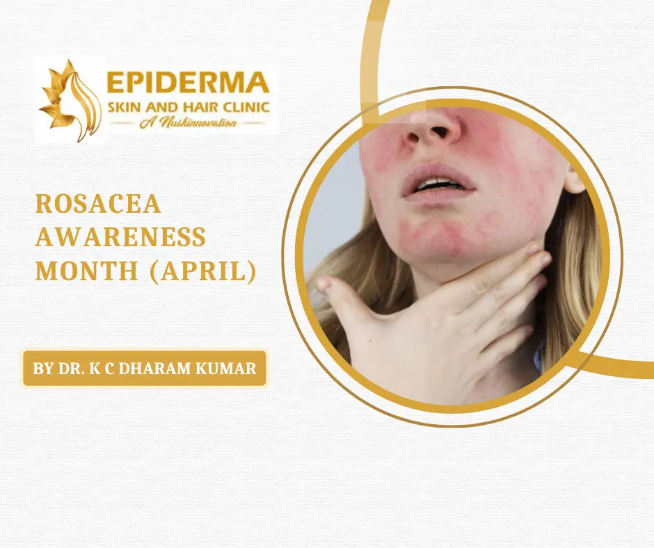 Skin Clinic in Bangalore