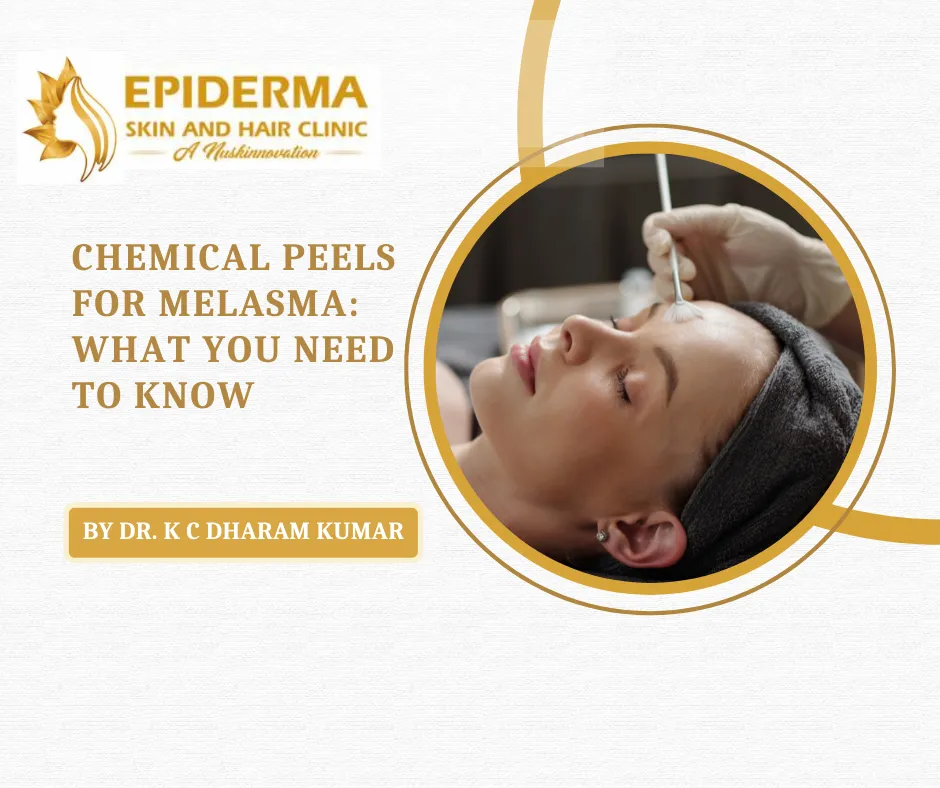 Chemical Peeling Treatment in Jayanagar